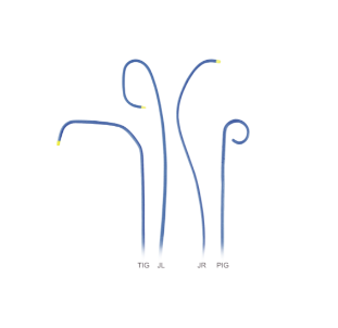 Intravascular Ultrasound (IVUS) Catheter