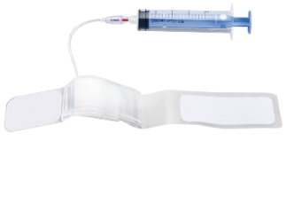 Coronary Laser Ablation System